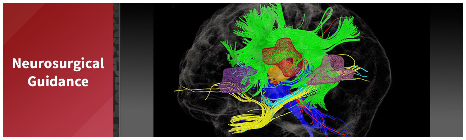 Neurosurgical Guidance – 3D and Quantitative Imaging Laboratory